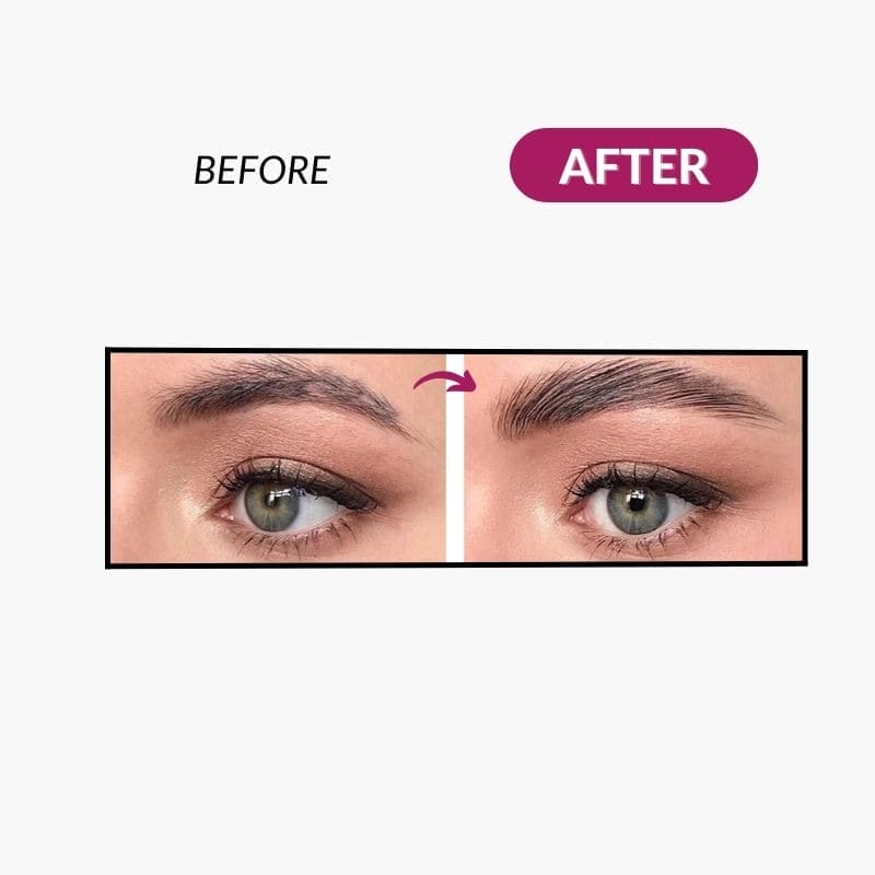 Ladies Facial Shaver™ - Melhino