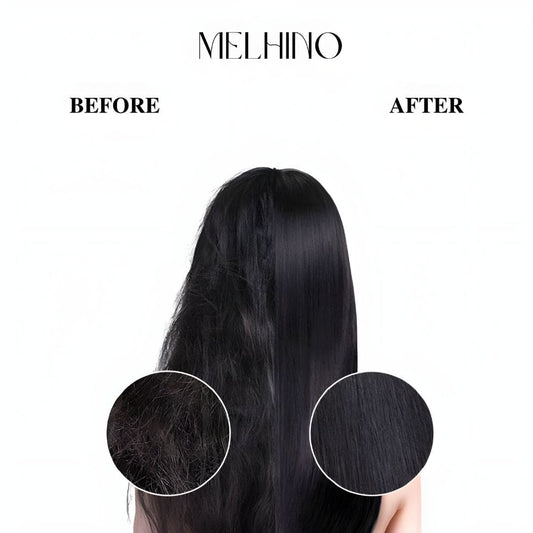 Hair Dryer Brush™ Deluxe - Melhino
